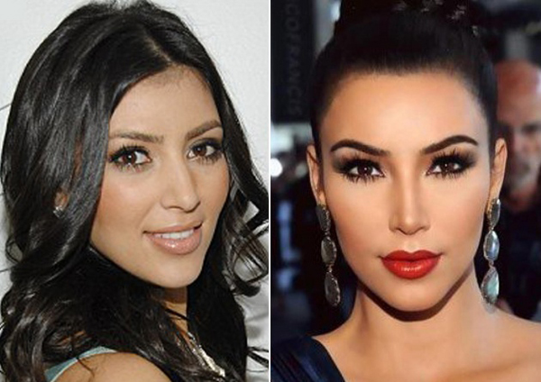 BG_Kim-Kardashian-nosejob-homepage