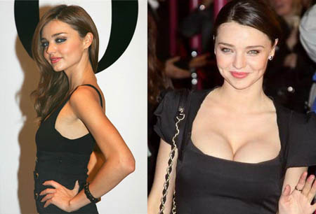 Celebrity-Miranda-Kerr-Before-After-Breast-Implants