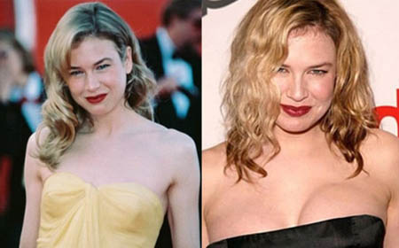 Has-Renee-Zellweger-had-breast-implants-plastic-surgery
