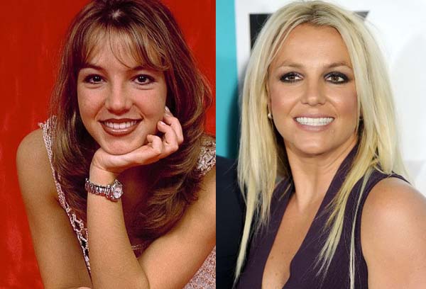 plastic-surgery-you-think-britney-had-page-the-103781