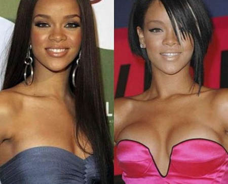 rihanna_before-after-celebrities-actress-plastic-surgery-breast-implant-photos-3