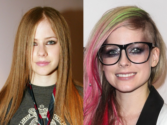 Avril-Levigne-Nose-Job