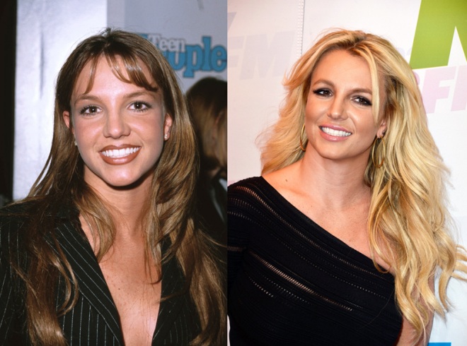 Britney-Spears-Nose-Job