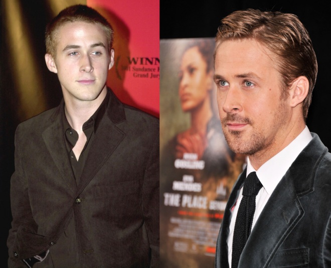 Ryan-Gosling-Nose-Job