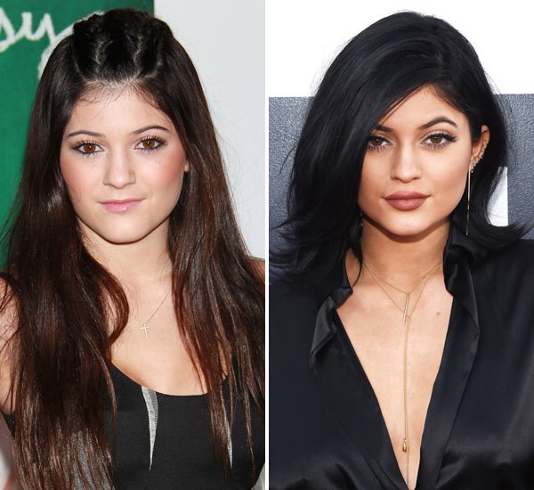 kylie-jenner-lip-injections-hollywoodlife-says-gty-ftr