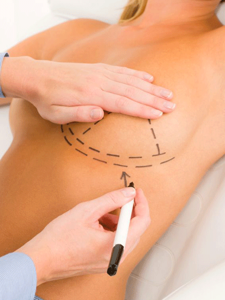 GÖĞÜS AMELİYATI DÜŞÜNEN HERKES BUNLARI BİLMELİ