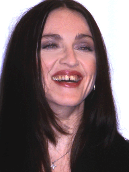 YILDIZLARIN ESKİ VE YENİ DİŞLERİ