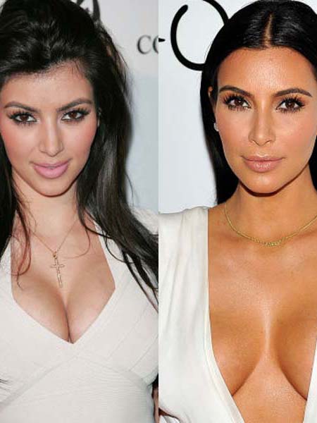 ÜNLÜ YILDIZLARIN GÜZELLİK HATALARI