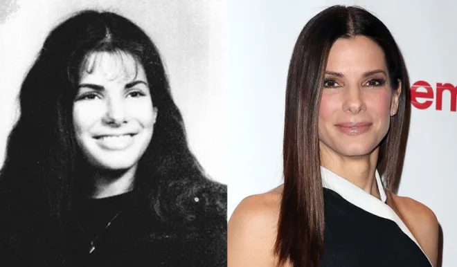 Sandra-Bullock-Nose-Job