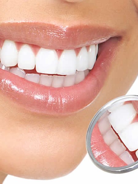 DİŞ BEYAZLATMA HAKKINDA DOĞRULAR