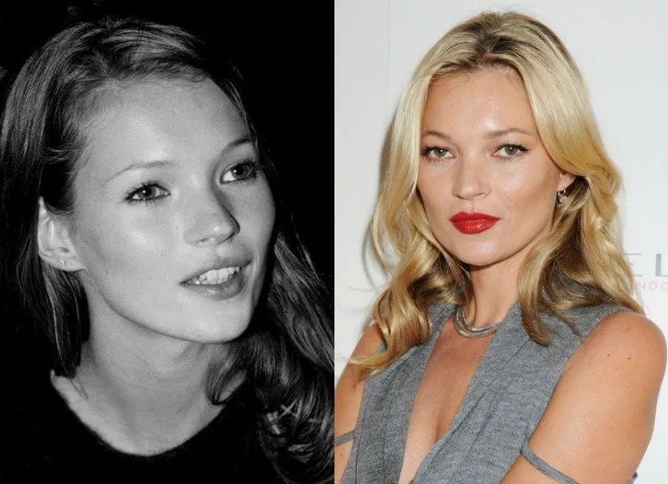 ÜNLÜ MODELLERİN MEŞHUR OLMADAN ÖNCEKİ HALLERİ 2