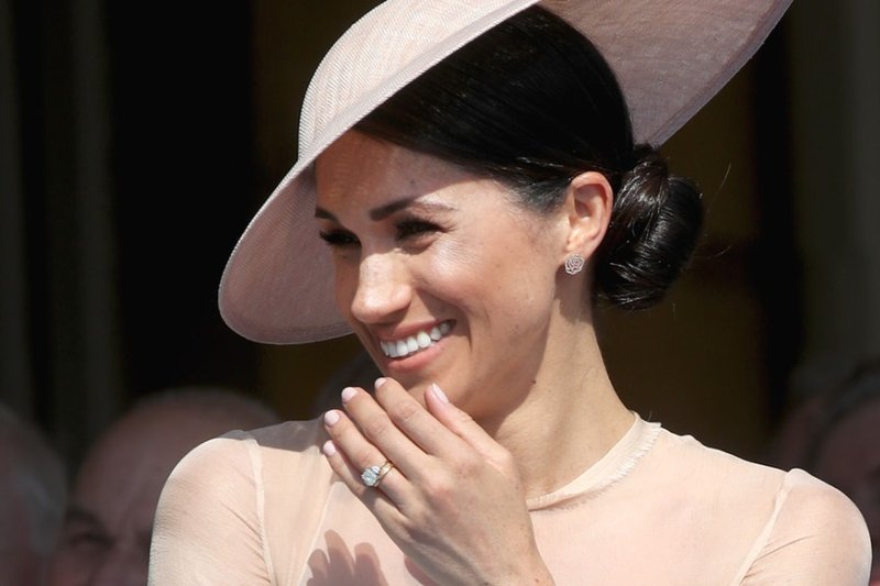 Düğün Sonrası Prens Harry’yi Arı soktu