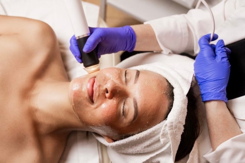 Yaz Dönüşü Can Sıkan “Cilt Lekeleri”ni Tedavide ve Cildi Sağlıklı Işıltısına Kavuşturmada Güncel Yaklaşımlar