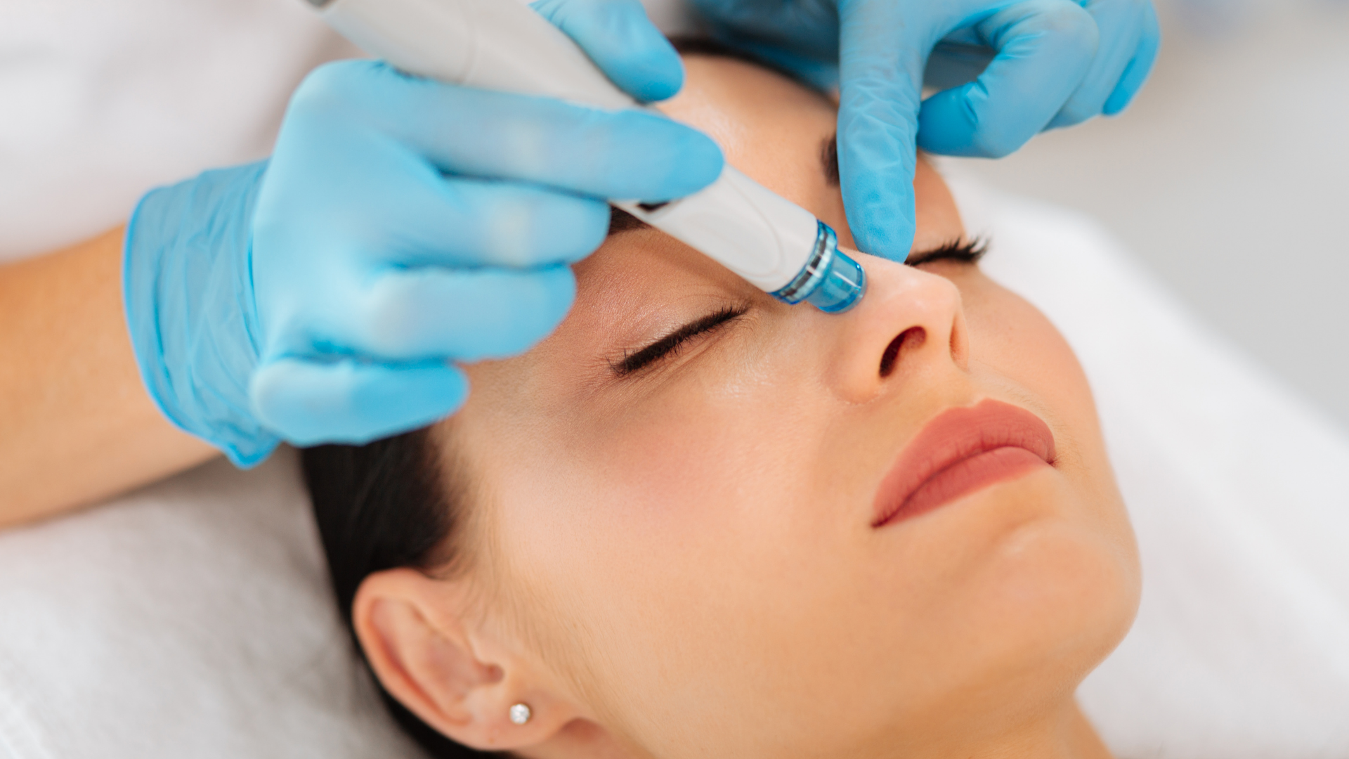 Medikal Cilt Bakımlarının Yükselen Yıldızı: Hydrafacial
